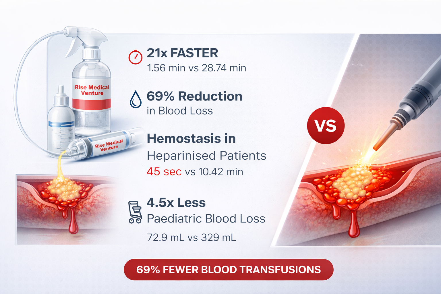 Rise Medical Venture mechanism illustration